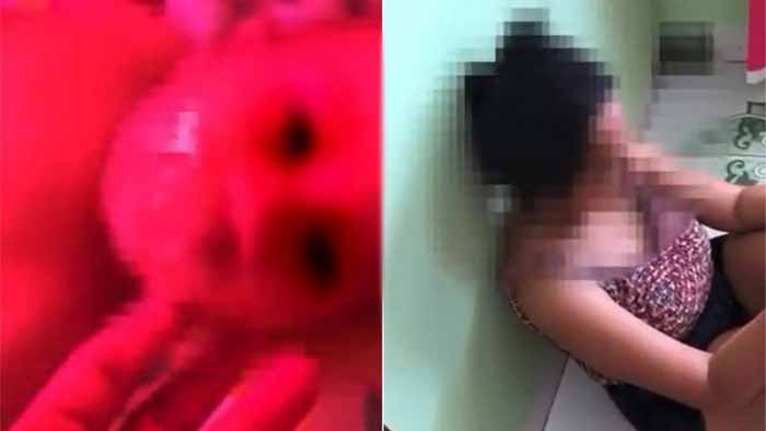 Bebê de 6 meses tem a boca tampada com fita adesiva pela mãe para ‘abafar’ barulho de choro; veja vídeo
